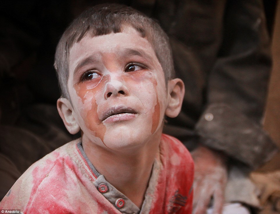 طفل سوري جريح يبكي بعد قصف الطيران الروسي لحي الفردوس الذي تسيطر عليه المعارضة في حلب